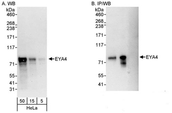 Rabbit anti-EYA4 Antibody