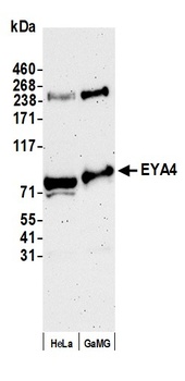 Rabbit anti-EYA4 Antibody
