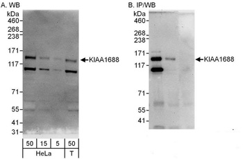 KIAA1688 Antibody