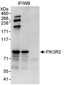 PIK3R2 Antibody