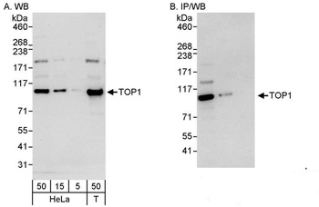 Rabbit anti-TOP1 Antibody