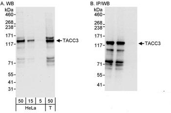 Rabbit anti-TACC3 Antibody