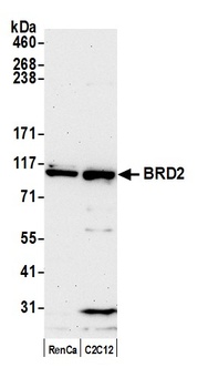 BRD2 Antibody