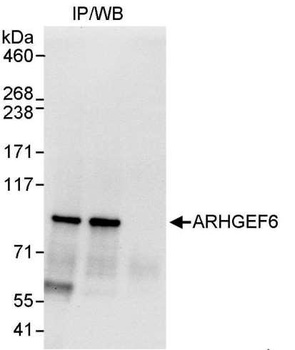 ARHGEF6 Antibody