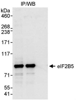 Rabbit anti-eIF2B5 Antibody