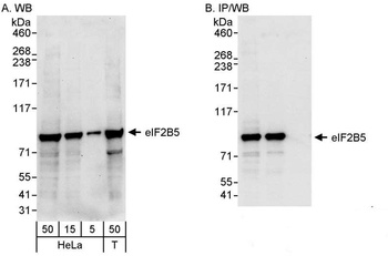 Rabbit anti-eIF2B5 Antibody