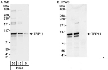TFIP11 Antibody