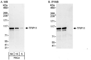 TFIP11 Antibody