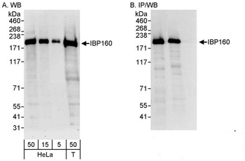 Rabbit anti-IBP160 Antibody