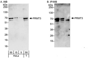 PRMT3 Antibody