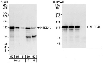 Rabbit anti-NEDD4L Antibody