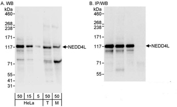 Rabbit anti-NEDD4L Antibody