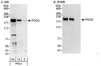 Rabbit anti-POGZ Antibody