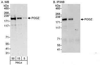 Rabbit anti-POGZ Antibody