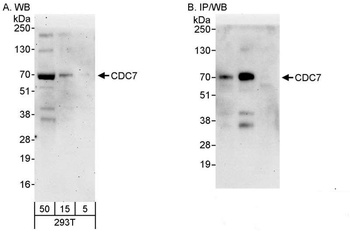 Rabbit anti-CDC7 Antibody