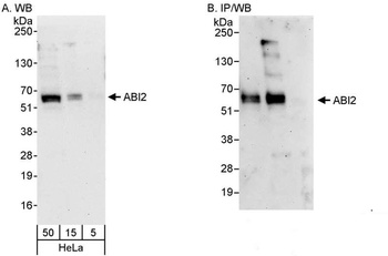 Rabbit anti-ABI2 Antibody