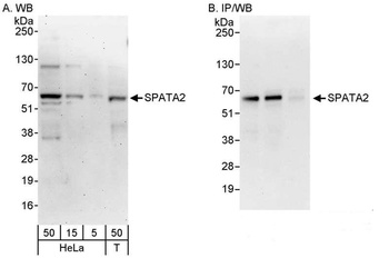Rabbit anti-SPATA2 Antibody