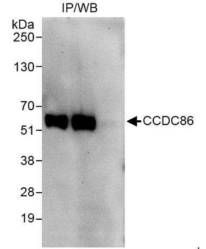 Rabbit anti-CCDC86 Antibody