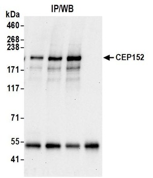 CEP152 Antibody