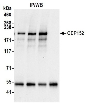 Rabbit anti-CEP152 Antibody