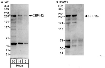 Rabbit anti-CEP152 Antibody