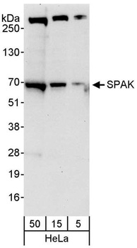 SPAK Antibody