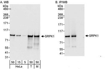 Rabbit anti-SRPK1 Antibody