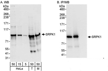 Rabbit anti-SRPK1 Antibody