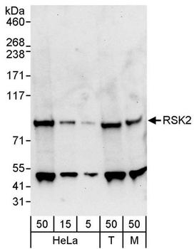 Rabbit anti-RSK2 Antibody