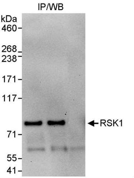 RSK1 Antibody
