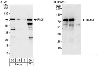 Rabbit anti-RIOK1 Antibody