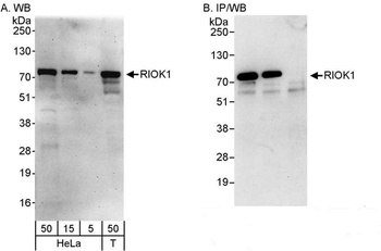 Rabbit anti-RIOK1 Antibody