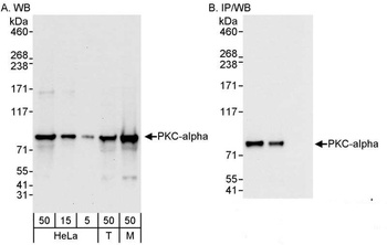 PKC-alpha Antibody