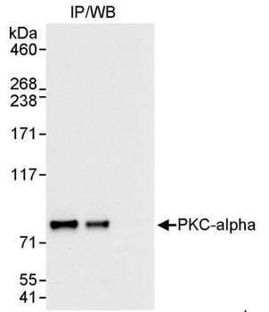 PKC-alpha Antibody