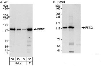 Rabbit anti-PKN2 Antibody