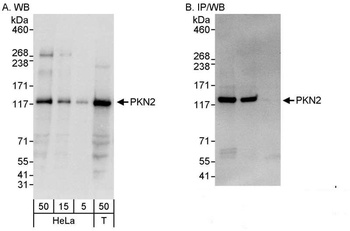 PKN2 Antibody