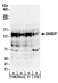 DAB2IP Antibody
