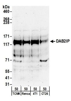 Rabbit anti-DAB2IP Antibody