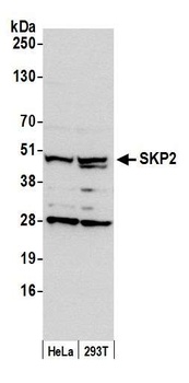 SKP2 Antibody