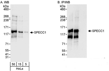 Rabbit anti-SPECC1 Antibody