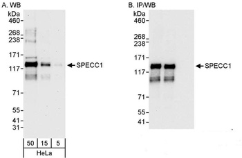 Rabbit anti-SPECC1 Antibody