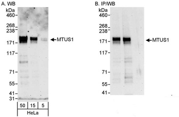 Rabbit anti-MTUS1 Antibody