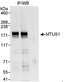 Rabbit anti-MTUS1 Antibody