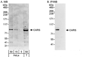 Rabbit anti-CARS Antibody