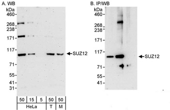 Rabbit anti-SUZ12 Antibody