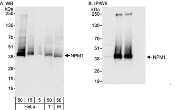 NPM1 Antibody