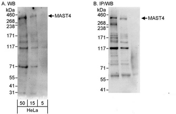 Rabbit anti-MAST4 Antibody