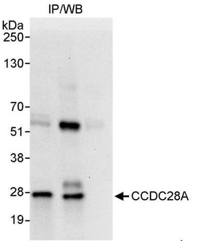 Rabbit anti-CCDC28A Antibody