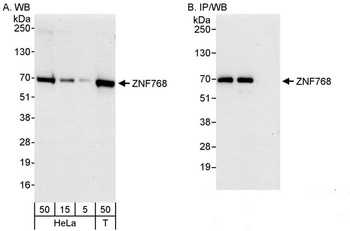 Rabbit anti-ZNF768 Antibody