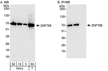 Rabbit anti-ZNF768 Antibody